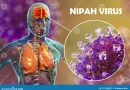 Understanding Nipah Virus: Origin, Symptoms, Prevention, and Treatment